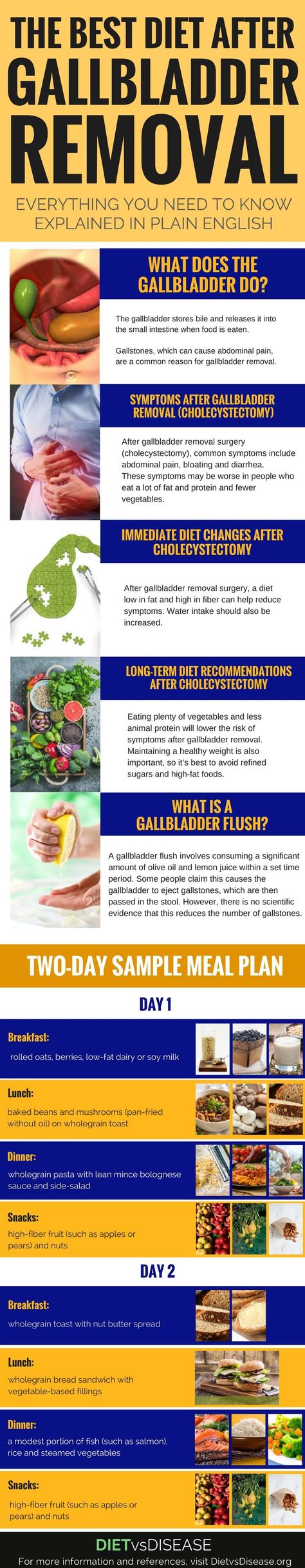 If you’ve had your gallbladder removed, you’ve likely been advised to change your diet.To do so, it’s helpful to know what the gallbladder does and the role it plays in digestion.This article will help you better understand the gallbladder and the best diet to follow after its removal. #dietitian #nutritionist #nutrition #gallbladder Life After Gallbladder Removal, Diet After Gallbladder Removal, Gallbladder Surgery Diet, Gallbladder Removal Diet, After Gallbladder Removal, Gallstone Diet, Gall Bladder Removal, After Gallbladder Surgery, Gallbladder Flush