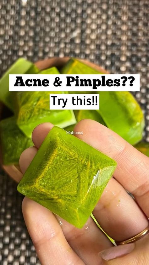 Relief from acne & pimples in 2022 | Healthy skin tips, Money life hacks, Acne and pimples Natural Skin Care Ingredients, Pimples Remedies, Clear Healthy Skin, Natural Skin Care Remedies, Diy Skin Care Routine, Face Pack, Good Skin Tips, Diy Skin Care Recipes, How To Get Rid Of Pimples