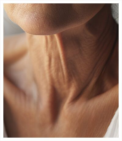 Age Brilliance Sagging Neck Skin, Tighten Neck Skin, Anti Aging Neck, Sagging Neck, Tighten Loose Skin, Skin Remedies, Loose Skin, Sagging Skin, Anti Aging Skin Products