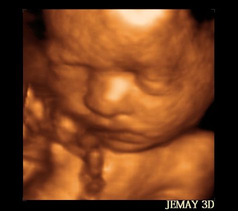 3D Ultrasound Jemay 3D Ultrasound Prenatal Ultrasound & Photo Studio. ” You Can Feel, You Can See” WWW.JEMAY3DMIAMI.COM Ultrasound Jemay 3D Ultrasound Prenatal Ultrasound & Photo Studio. ” You Can Feel, You Can See” WWW.JEMAY3DMIAMI.COM #jemay3d #pregnancy #pregnant #maternity #mother2be #baby2be #expecting #ultrasounds #parenthood #jemay3dmiami.com #jemay3d #3d ultrasound#4dultrasound #2dultrasound #prenatalimage #photostudio #firstimpresion #fetus #firstimage #28weeks #babybump 3d Ultrasound, Benjamin Wadsworth, Prenatal, Ultrasound, Photo Studio, 3 D, Greek Statue, Statue