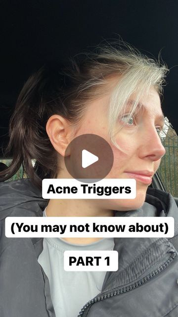 35 likes, 2 comments - lifewithkaraolivia on January 30, 2024: "Acne Triggers Part 1 ✨ Save & Sceenshot 📸 to refer back to if needed! Our bodies are so co..." Acne Triggers, Acne Pictures, Healing Acne, Bad Acne, The Bigger Picture, Bigger Picture, Acne Marks, My Skin, Our Body