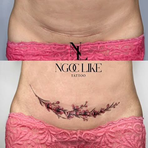 40 Times People Asked To Cover Up Their Scars And This Tattoo Artist Nailed It (New Pics) Tattoo Cover Scar Belly, Abdominal Scar Tattoo Cover Up, C Section Scar Tattoo Cover Up, Tattoo Cover Scar Arm, Scar Cover Up Tattoos For Women, Mami Tattoos, Tattoo On Scar, Scar Tattoo Cover Up, Scar Cover Up Tattoo