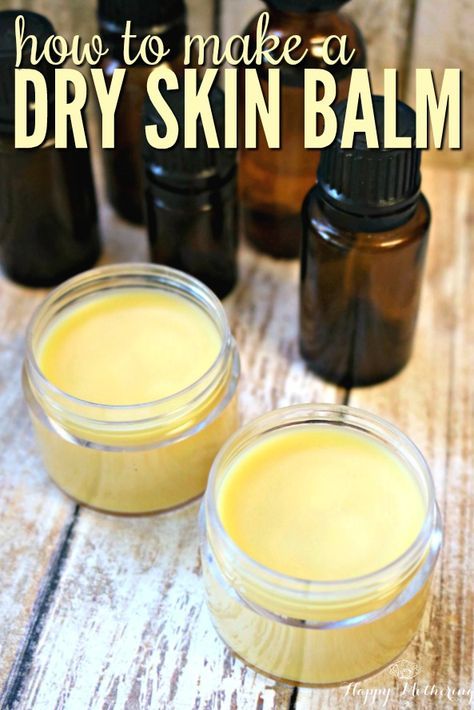 Dry Skin Diy, Balm Recipe, Extremely Dry Skin, Skin Care Routine For 20s, Skin Balm, Diy Kosmetik, Combination Skin Type, Natural Healing Remedies, Avon Products