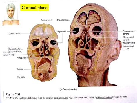 cadaver coronal sinus head - Ecosia - Images Cross Section, Human Anatomy, Renewable Energy, The Search, Trees To Plant, Search Engine, Anatomy, Art Inspiration, Trees