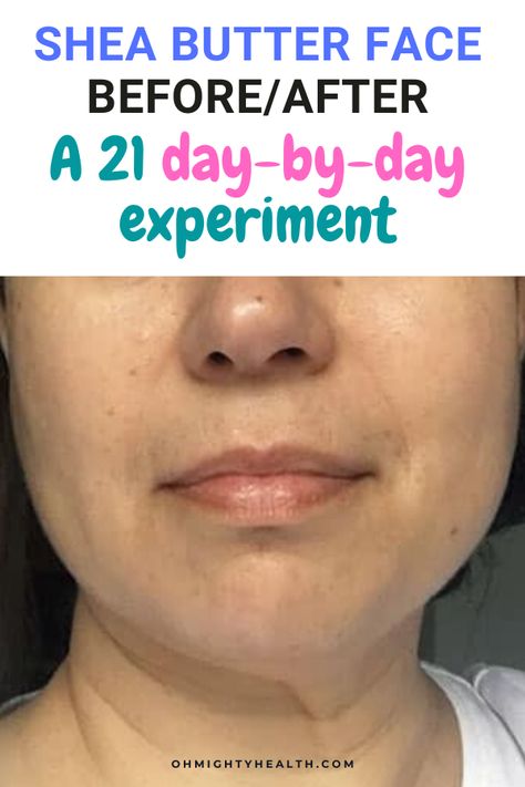 I applied shea butter on my face at night for 21 days. I documented the daily changes and took some photos. Have a look, see what you think. Shea butter is a great natural ingredient. #sheabutter #sheabutteronface #sheabutterbeforeafter #naturalskincare #naturaloils #naturalbutters Essential Oils For Wrinkles, Oils For Wrinkles, Shae Butter, Shea Butter Face, Shea Butter Recipes, Shea Butter Benefits, Homemade Wrinkle Cream, Whipped Shea Butter, Nutrition Food