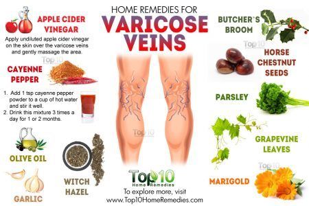 (1) New Messages! Varicose Vein Remedy, Top 10 Home Remedies, Holistic Remedies, Natural Therapy, Natural Home Remedies, Health Remedies, Herbal Remedies, The Skin, Cayenne