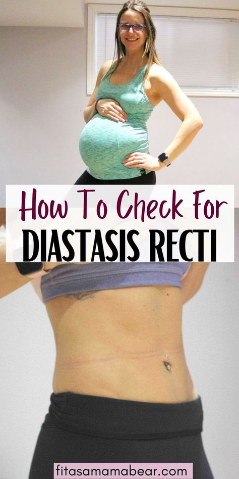 Pin image with text: text about testing for diastasis recti and one image of a pregnant lady holding her bellow and the other of a bare mid section Abdominal Rectus Diastasis Recti, What Is Diastasis Recti, Rectus Abdominis Muscle, Healing Diastasis Recti, Diastasis Recti Exercises, Healthy Pregnancy Tips, Happy Pregnancy, Weight Changes, Prenatal Care