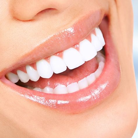 Natural Teeth Whitening Diy, Pretty Teeth, Kesehatan Gigi, Veneers Teeth, Beautiful Teeth, Whitening Teeth, Teeth Whitening Diy, Teeth Whitening Toothpaste, Charcoal Teeth Whitening