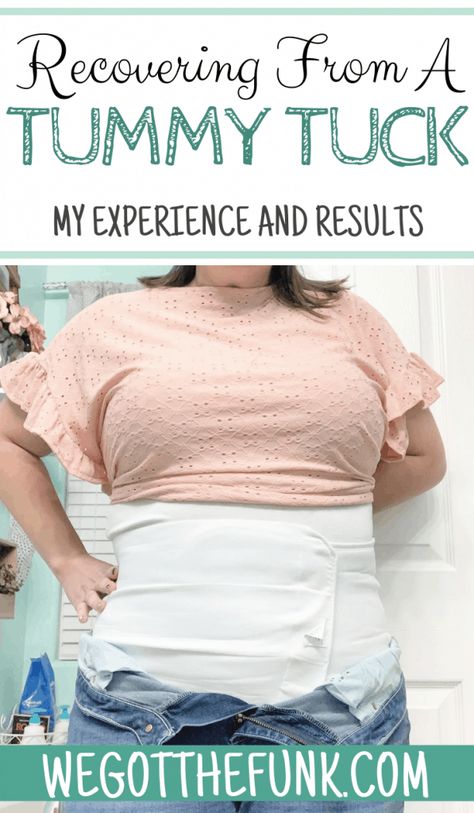 I had a drainless tummy tuck completed in Colorado and am sharing my recovery from a tummy tuck with results and what to expect. Plus Size Mommy Makeover Surgery, Diastasis Recti Surgery Before And After, Tummy Tucks Recovery Timeline, Tummy Tucks Post Op, Plus Size Tummy Tucks Before And After, Tummy Tucks Recovery List, Sono Bello Before And After, Tummy Tucks Recovery Tips, Mommy Makeover Surgery Before And After Tummy Tucks