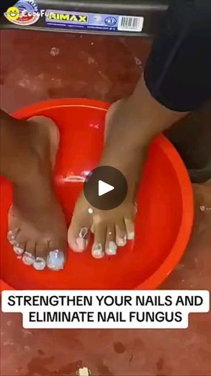 Side Stretches, Yellow Toe Nails, Nail Remedies, Hand Washing Poster, Easy Care Hairstyles, Nail Fungus Remedy, Toenail Fungus, Nail Fungus, Yellow Nails