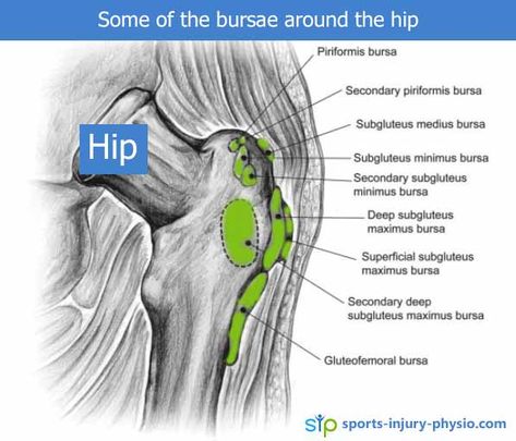 Bursitis Hip Relief, Greater Trochanteric Pain Syndrome, Bursitis Hip, Referred Pain, Gluteal Muscles, Piriformis Syndrome, Spine Health, Body Anatomy, Sports Injury