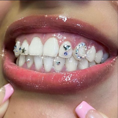 Tooth Gem Placement, Tooth Gems Ideas, Teeth Gems, Pretty Teeth, Dental Jewelry, Grillz Teeth, Diamond Teeth, Tooth Gems, Grills Teeth