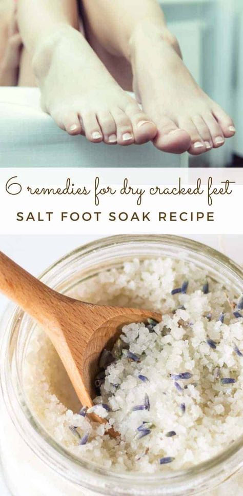 This detoxifying foot bath recipe is the best foot bath that you can do at home. This natural foot soak is perfect for a gentle detox for the body and for stress relief. Easy DIY essential oil foot soak for all ages. #naturaldetox #footbath #footsoak #detoxfootbath #epsomsaltbath Diy Foot Scrub Recipes, Foot Scrub Recipe, Homemade Foot Scrub, Homemade Foot Soaks, Foot Detox Soak, Diy Foot Soak, Foot Soak Recipe, Bath Recipes, Foot Scrub