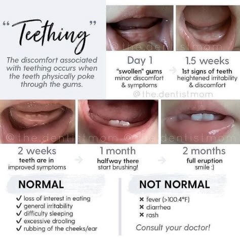 Teething Signs, Pregnancy Help, Baby Routine, Newborn Baby Tips, Newborn Mom, Baby Information, Baby Life Hacks, Baby Facts, Smart Parenting