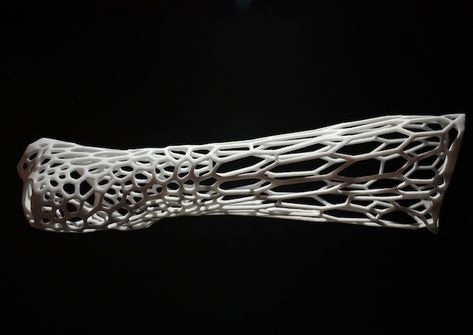 Lattice structure design - DASSAULT: CATIA products - Eng-Tips Heal Broken Bones, 3d Printing Architecture, Lattice Structure, Machine 3d, Bone Fracture, Plaster Cast, Architecture 3d, Medical Technology, Futuristic Design