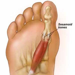 Frankincense Oil Uses, Sesamoid Bone, Morton's Neuroma, Tomato Nutrition, Calendula Benefits, Coconut Benefits, Matcha Benefits, Joints Pain Relief, Insect Bites