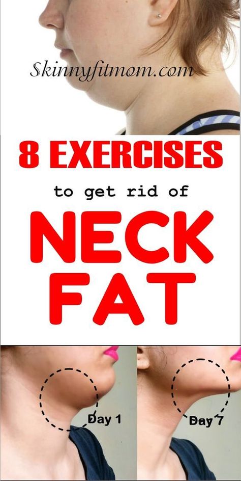 Reduce Face Fat, Jawline Exercise, Double Chin Exercises, Chin Exercises, Motivație Fitness, Double Menton, Lose Thigh Fat, Simple Exercise, Neck Exercises