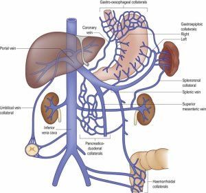 Venous System, Lymph Vessels, Vein Thrombosis, Basic Anatomy And Physiology, Arteries And Veins, Cell Line, Human Body Anatomy, Medical Anatomy, Diagram Design