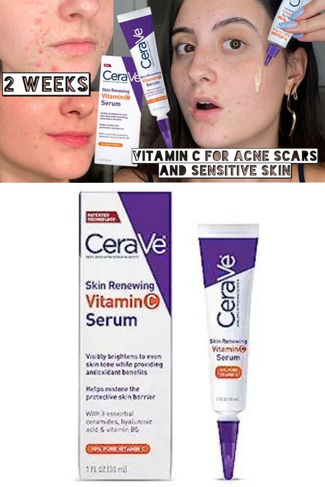 Cerave Vitamin C Serum, Serum For Face, Oily Skin Care, Skin Serum, Vitamin C Serum, Brightening Serum, Ascorbic Acid, Protective Packaging, Fragrance Free