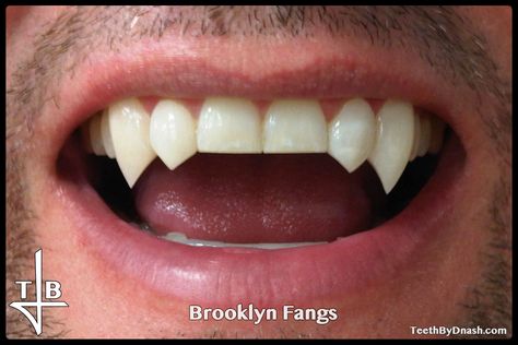 Permanent Fangs, Bottom Fangs, Cute Fangs Teeth, Fang Teeth Natural Aesthetic, Cosplay Fangs, Teeth Claim Fangs, Fake Fangs, Tooth Filling, Emo Tattoos