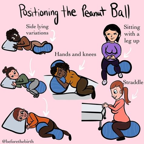 Labor Positions, Peanut Ball, Baby Number 2, Doula Services, Birth Doula, Birth Labor, Labor Delivery, Labor, Peanut