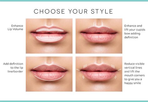 Bigger Lips Naturally, Dermal Fillers Lips, Lips Inspiration, Botox Cosmetic, Fat Grafting, Cosmetic Injectables, Lip Augmentation, Facial Aesthetics, Lip Filler