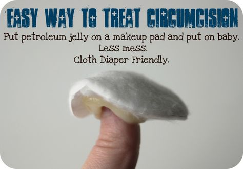 Treating a circumcision without the mess--works for both disposables and cloth diapers Cloth Diapering Newborn, Cloth Diapering, Petroleum Jelly, Newborn Care, Baby Time, Baby Health, Great Job, Baby Life, Baby Hacks