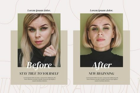 Before And After Graphic Design, Before After デザイン, Before And After Background, Before After Template, Before And After Template, Healthcare Inspiration, Medical Branding, Post Layout, Glam Studio