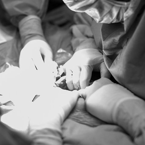 Jaw-Dropping Photos From a C-Section Birth Scheduled C Section, Home Births, Operating Theatre, To Build A Home, Hospital Photography, Birth Photos, Build A Home, Birth Photographer, Home Birth