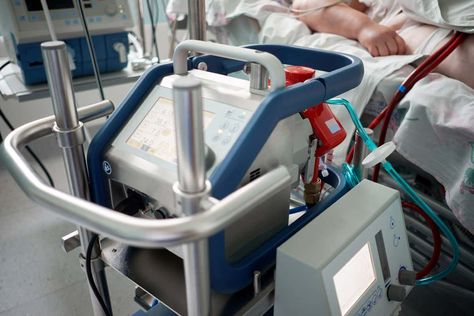 An ECMO (extracorporeal membrane oxygenation) machine is a life support machine that takes over the function of the heart and lungs. When patients are connected to an ECMO machine, their blood is pumped via tubes to a machine that adds oxygen and removes carbon dioxide, like the lungs normally would, which is then pumped back … Ecmo Machine, Life Support Machine, Pneumonia Causes, Cardiogenic Shock, Acute Kidney Injury, Preterm Labor, Lung Transplant, Gestational Age, Mechanical Ventilation