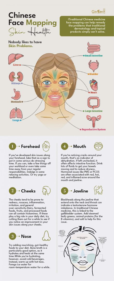 Improve Your Skin Health with Chinese Face Mapping | Mien Shiang Chinese Facial Mapping, Chinese Face Mapping Acne, Acne Chart Face Mapping, Chinese Medicine Face Map, Face Mapping Health, Face Health Chart, Acne Mapping Face, Face Acne Chart, Acne Map