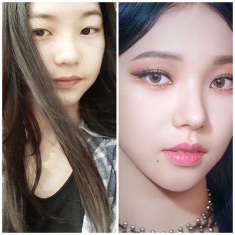 Karina Before And After Surgery, Korean Rhinoplasty, Aespa Karina, After Surgery, Beauty Standards, Simple Bedroom, Plastic Surgery, Surgery, Photoshop