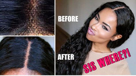 What Wig Sis?! How to HIDE the HOLES on the Lace! Make it Look Like Your Scalp! (NEW STAR HAIR) [Video] - https://blackhairinformation.com/video-gallery/wig-sis-hide-holes-lace-make-look-like-scalp-new-star-hair-video/ Herbal Hair Growth Oil, Youtube Hair Tutorials, Wig Tips, Herbal Hair Growth, I Like Your Hair, Frontal Hair, Closure Weave, Diy Wig, Hair Weaving