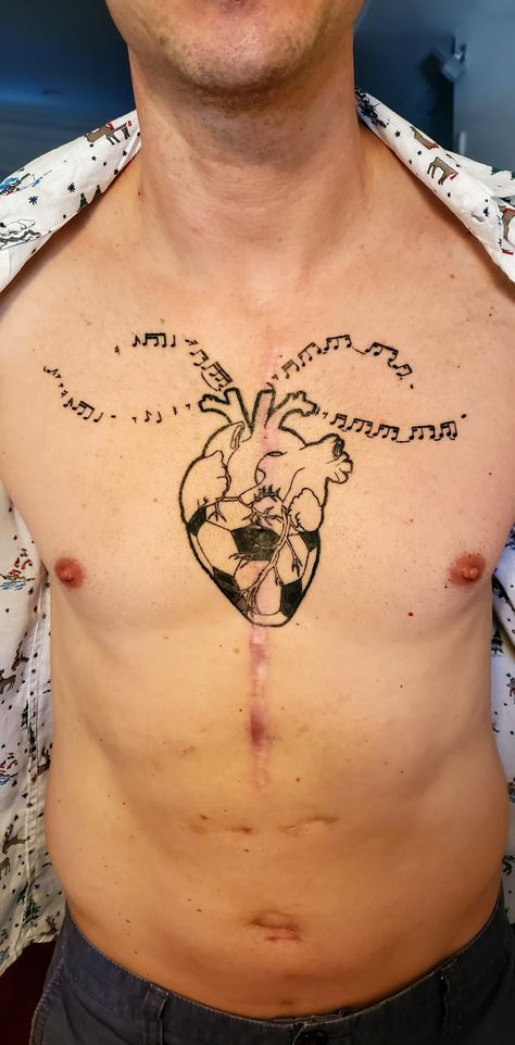 Surgery Tattoo Cover Up, Tga Heart Tattoo, Football Heart Tattoo, Heart Surgery Tattoo Ideas, Heart Scar Tattoo, Open Heart Surgery Tattoo, Heart Surgery Tattoo, Chest Tattoo Heart, Surgery Tattoo