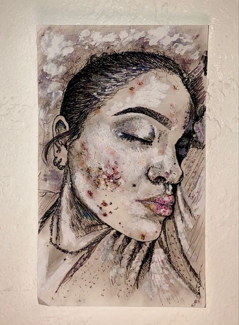 Acne Aesthetic Art, Painting On Insecurity, Insecure Face Drawing, Acne Illustration Art, Acne Art Drawing, Acne Positivity Art, How To Draw Acne, Drawing Acne, Acne Drawing