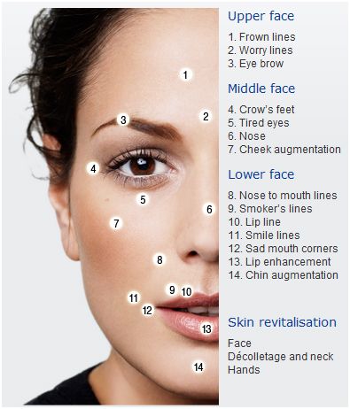 Anatomy Landmarks, Surface Anatomy, Botox Injection Sites, Injection Sites, Botox Before And After, Art Notes, Aesthetic Dermatology, Botox Face, Face Anatomy