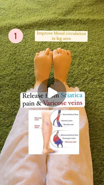 𝗨𝗿𝘃𝗮𝘀𝗵𝗶 🦋 || 𝗬𝗼𝗴𝗮 𝗧𝗲𝗮𝗰𝗵𝗲𝗿 🧘‍♀️ on Instagram: "Exercises for varicose veins ✅  Varicose veins are large, protruding veins that appear on the skin and may have a bluish, purplish colour.  🌿 Pain, cramps, and heaviness in the legs.  🌿Swollen, bulging, and/or twisted veins that appear to be pushing the skin   🌿Darkened bluish, reddish, or purplish veins in a web-like or rope-like form.  🌿Itchiness near the veins.  🌿Pain that worsens when you sit or stand for long periods  When you notice these symptoms, you need to consult with your doctor as soon as you can.  Repeat each exercise 20 times ✅  #vericoseveins #sciatica #sciaticarelief #sciaticapain #yogateacher #exercise #dailypractice #yoga #health #lifestyle #instagram #healthylifestyle #legexercises #therepy #tips #re Vericose Veins Pregnant, Varicose Veins Exercises, Varicose Veins Causes, Breast Firming Exercises, Varicose Vein Remedy, Leg Veins, Heavy Legs, Sciatica Exercises, Sciatica Relief