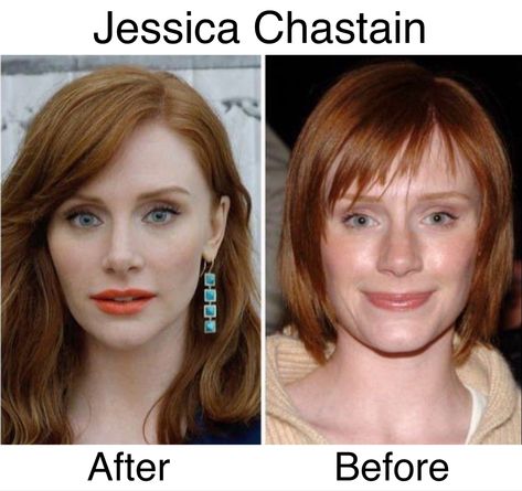 Bad Celebrity Plastic Surgery, Celebrity Surgery, Plastic Surgery Fail, Nose Jobs, Rhinoplasty Nose Jobs, Plastic Surgery Photos, Plastic Surgery Gone Wrong, Face Surgery, Celebs Without Makeup