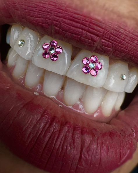 don’t you just love when a first timer becomes a regular 💅 SS3: Bling | SS5: Baby Girl 🌸 ✨ yes there’s gems runnin loose on her lip✨ - #toothgemsaustralia #toothgemsupplier #toothgems #ledcuringlight #toothgemwholesale #australia #worldwideshipping #toothgemgirlies #thetoothfairyiscoming #comingsoon #toothgeminspo #chandeliertooth #swarovski #swarovskitoothgems #swarovskicrystals #shopifystore #empoweringwomen #18kgoldtoothgems Green Teeth, Gem Logo, Pretty Teeth, Dental Jewelry, Grillz Teeth, Gold Tooth, Tooth Ring, Diamond Teeth, Tooth Charm