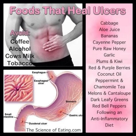 Foods that help heal ulcers. Foods For Ulcers, Ulcer Diet, Stomach Ulcers, Stomach Issues, Healing Food, Acid Reflux, Health Info, Cool Stuff, Body Health