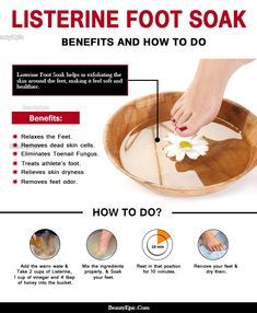 Home Foot Soak, Pedicure Soak, Listerine Foot Soak, Foot Soak Recipe, Diy Pedicure, Athletes Foot, Pedicure At Home, Skin Dryness, Foot Soak