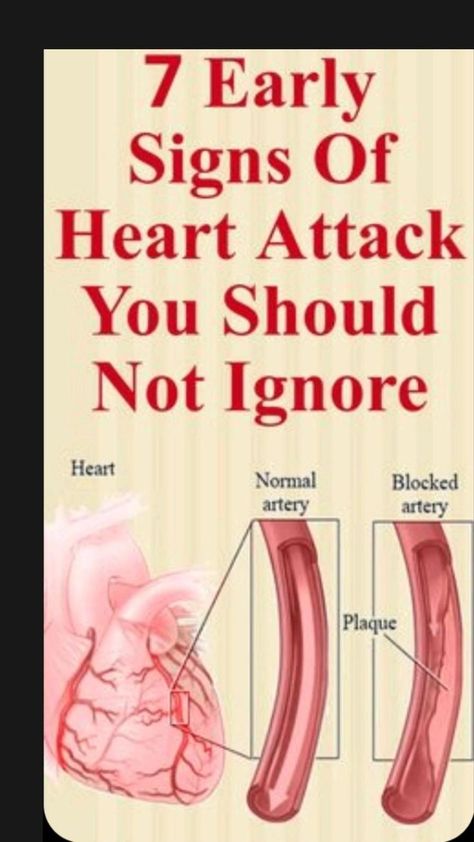 A month before a heart attack, your body will warn you with ... signs of heart problems signs of blockage in heart how to know if your heart is healthy early signs of heart disease heart check heart calculator heart foundation cardiac insufficiency Heart Blockage, Health Signs, Tongue Health, Natural Colon Cleanse, Health And Fitness Magazine, Vicks Vaporub, Oral Health Care, Fitness Advice, Good Health Tips