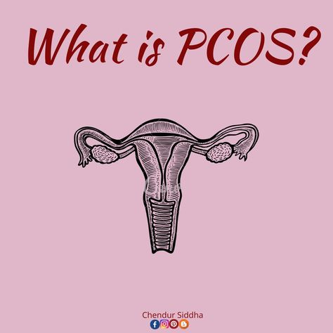 Polycystic ovarian syndrome (PCOS) is a hormonal disorder common among reproductive age. It is characterised by High level of androgens Menstrual irregularities and polycystic ovaries. The diagnosis of PCOS is given when someone has two or more of these features. Cystic Ovaries, Polycystic Ovarian Syndrome, Probiotic Foods, Polycystic Ovaries, High Level, Probiotics, When Someone, Disease, Signs