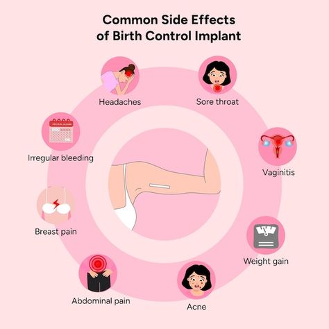 Common side effects from birth control i... | Premium Vector #Freepik #vector #concept #information #healthcare #medication Contraceptives Poster, Implant Birth Control, Birth Control Implant, Medical Study, Contraception Methods, Contraceptive Pill, Nursing School Motivation, Study Essentials, Colon Health