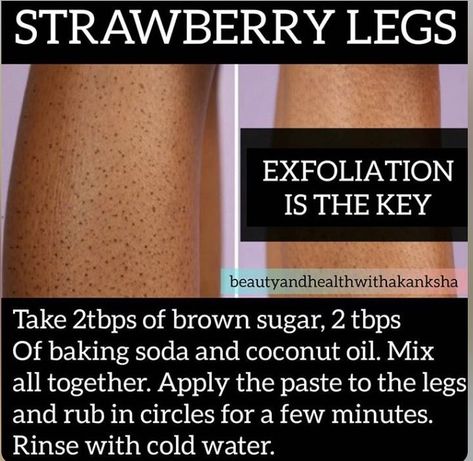 Strawberry Legs Remedy, Strawberry Skin, Strawberry Legs, Soft Legs, Bad Acne, Natural Skin Care Ingredients, Natural Skin Care Remedies, Beautiful Skin Care, Good Skin Tips