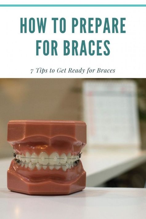 I think every kid and parent dreads getting braces. Here are some tips to prepare for that dreaded day. Getting Braces, Lifestyle Hack, Discipline Kids, Fit Board Workouts, Healthy Eating Tips, Fitness Motivation Quotes, Healthy Nutrition, Healthy Living Tips, Health Healthy