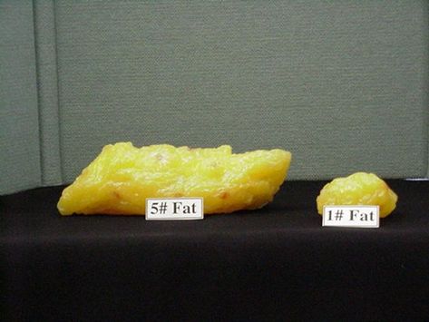 Good motivation: One pound of fat may be more than you realize 5 Lbs Of Fat, One Pound Of Fat, Lose 5 Pounds, Pound Of Fat, Migraine Headaches, Lose 20 Pounds, Quick Healthy, Migraine, Fitness Nutrition