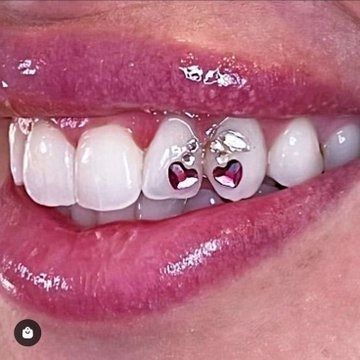 ˖ ࣪ 𝜗𝜚 on X: "i need these so bad https://t.co/qcUD7qfXWW" / X Cherry Tooth Gem, Teeth Gems Ideas, Teeth Jewels, Teeth Gems, Pretty Teeth, Dental Jewelry, Grillz Teeth, Diamond Teeth, Dope Jewelry Accessories