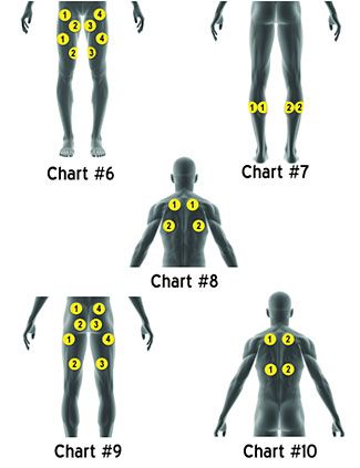 StimRx Electronic Muscle Stimulation (EMS) - Pad Placement Charts Tens Placement, Tens Unit Placement, Cauda Equina, Tens Machine, Tens Unit, Tens Ems, Ten Unit, Spine Health, Muscle Stimulator