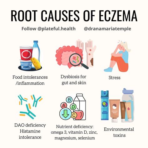 Dr Vivian Chen on Instagram: “Eczema is a chronic condition that is frustrating and infuriating while leaving us feeling helpless. 💙Join post @plateful.health 🤝…” Medical Ultrasound, Skin Advice, Itching Skin, Allergy Remedies, Clear Healthy Skin, Feeling Helpless, Mental Health Care, Skin Disorders, Skin Remedies